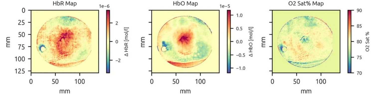 Mapas de HbR, HbO y saturación de oxígeno del Caso 2 (fibroadenoma), sin ninguna zona focal destacada