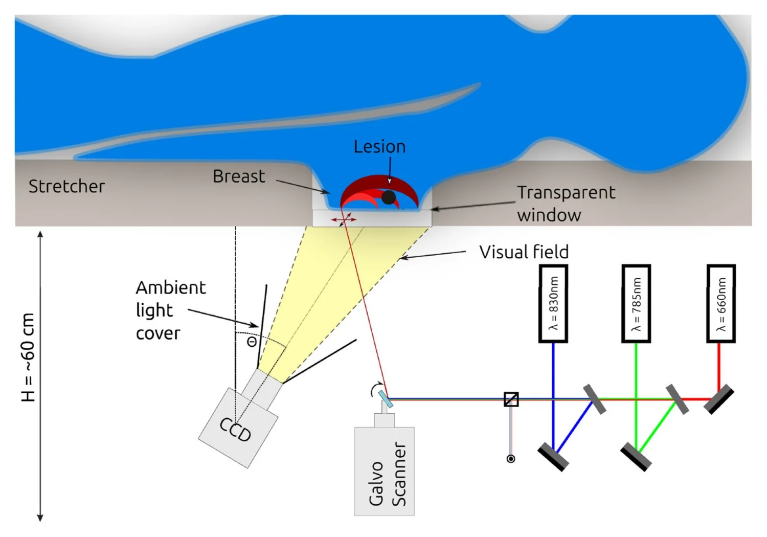 Esquema del dispositivo MamoRef publicado en el paper de 2026: tres láseres combinados en un único haz dirigidos por un galvo-scanner, con una cámara CCD capturando la reflectancia difusa de la mama